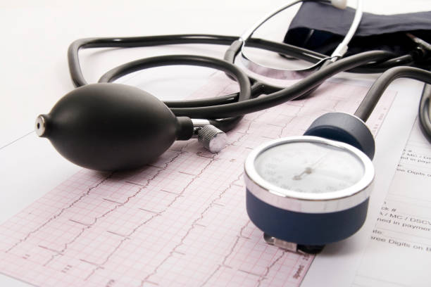 Auscultation of Atrial Fibrillation A Detailed Guide