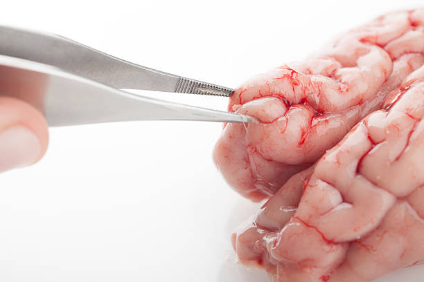 Complications of Untreated Obstruction