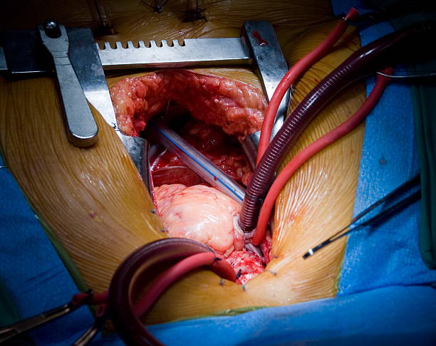 Diagnosing Intestinal Obstruction with a Stethoscope