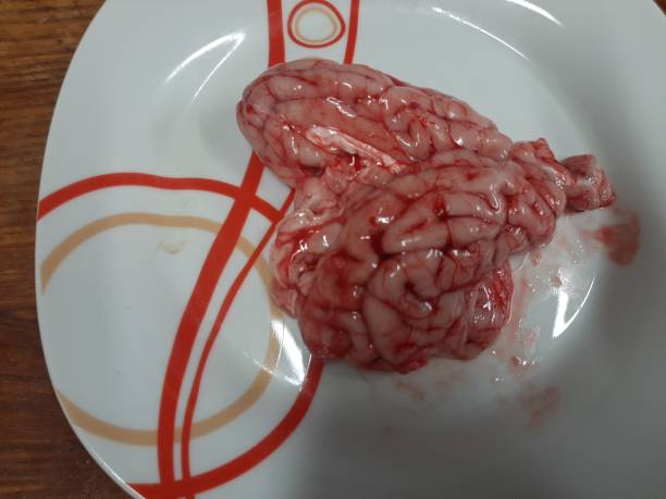 Diagnosing Intestinal Obstruction with a Stethoscope