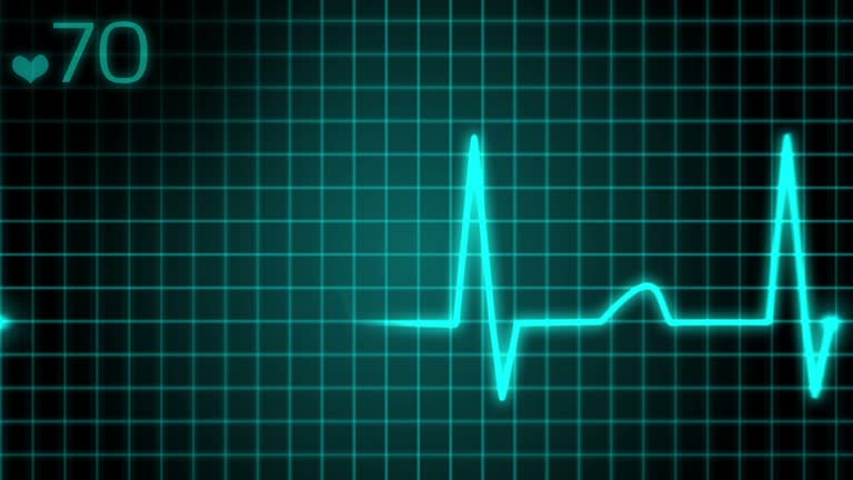 S3 (Third Heart Sound) Ventricular Gallop