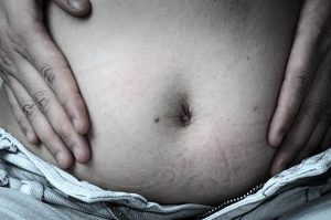 Stethoscope Use in Inflammatory Bowel Disease (IBD)