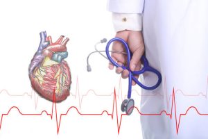 Stethoscope Use in Stroke A Comprehensive Guide