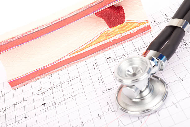 The Role of Stethoscopes in Advanced Heart Failure Management