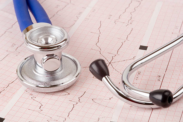 Where Can You Buy a Precordial Stethoscope