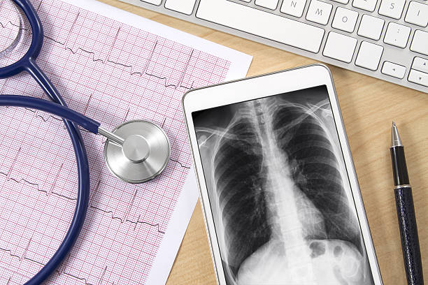 AI-Powered Stethoscopes